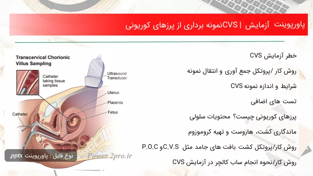 دانلود پاورپوینت آزمایش CVS | مثل  برداری از پرزهای کوریونی - کد117490