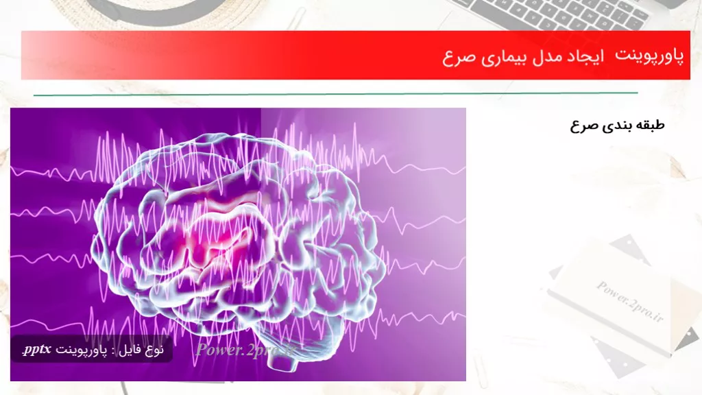 دانلود پاورپوینت ایجاد مدل بیماری صرع - کد117580