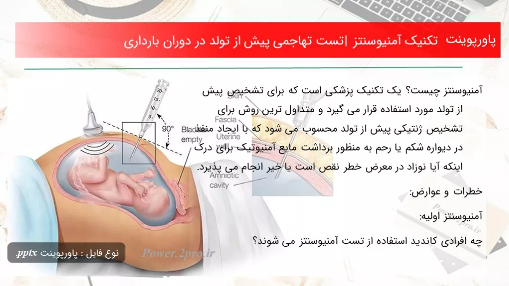 دانلود پاورپوینت تکنیک آمنیوسنتز | تست تهاجمی پیش از تولد در دوران بارداری - کد117647