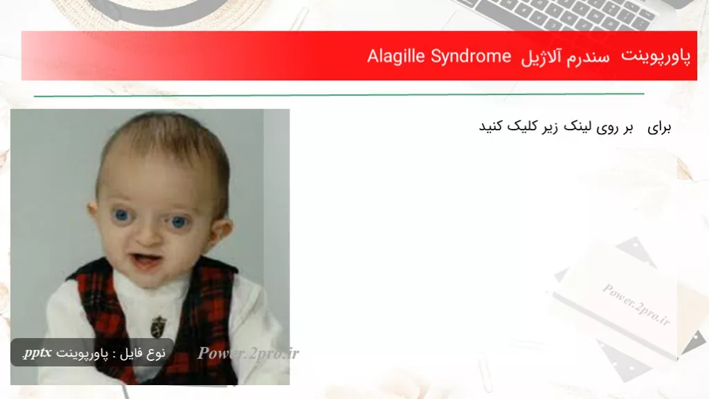 دانلود پاورپوینت سندرم آلاژیل Alagille Syndrome - کد117719