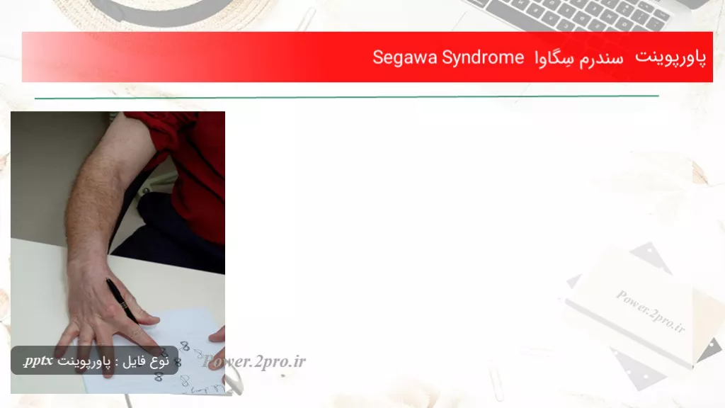 دانلود پاورپوینت سندرم سِگاوا Segawa Syndrome - کد117730