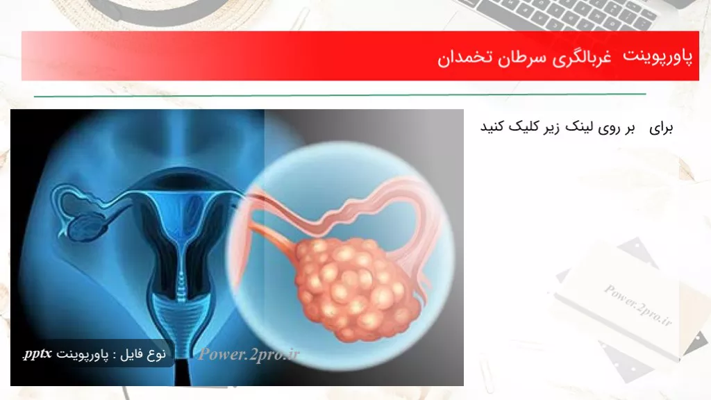 دانلود پاورپوینت غربالگری سرطان تخمدان - کد117765