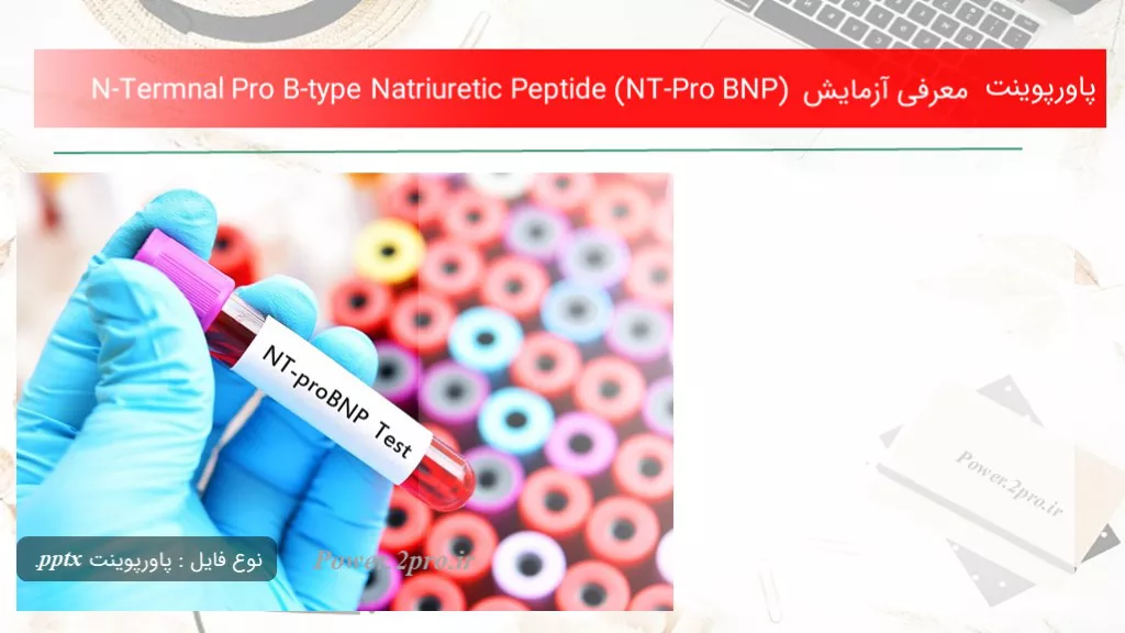 دانلود پاورپوینت معرفی آزمایش N-Termnal Pro B-type Natriuretic Peptide (NT-Pro BNP) - کد117796