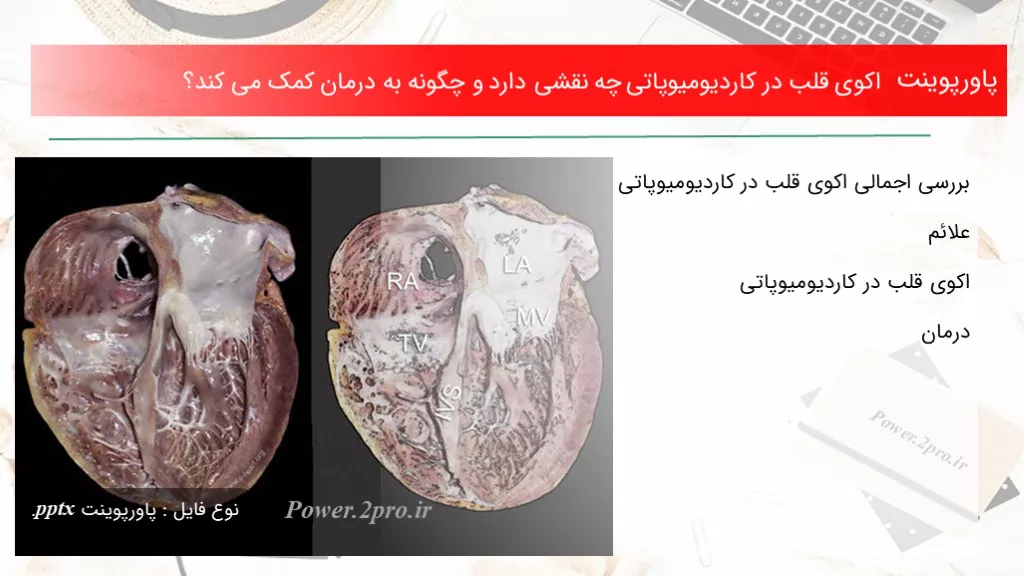 دانلود پاورپوینت اکوی قلب در کاردیومیوپاتی چه نقشی دارد و  چطور به درمان کمک می کند؟ - کد118213