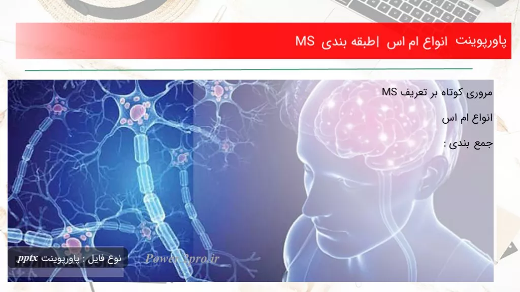 دانلود پاورپوینت انواع ام اس | طبقه بندی MS - کد118246