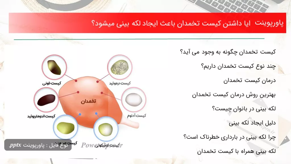 دانلود پاورپوینت ایا داشتن کیست تخمدان  علت ایجاد لکه بینی میشود؟ - کد118502