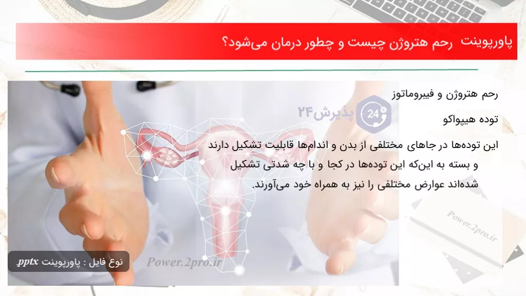 دانلود پاورپوینت رحم هتروژن چه چیزی است و چگونه درمان می‌شود؟ - کد118557