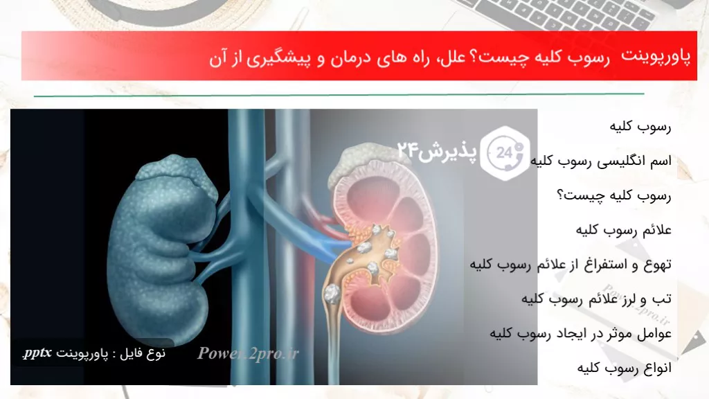 دانلود پاورپوینت رسوب کلیه چه چیزی است ؟ علل، راه های درمان و پیشگیری از آن - کد118558