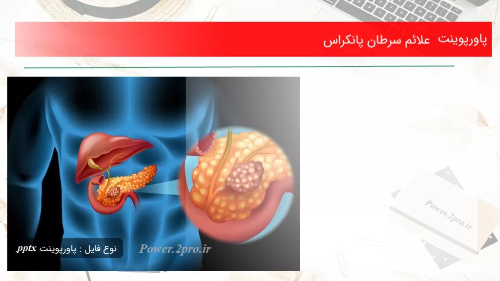 علائم سرطان پانکراس