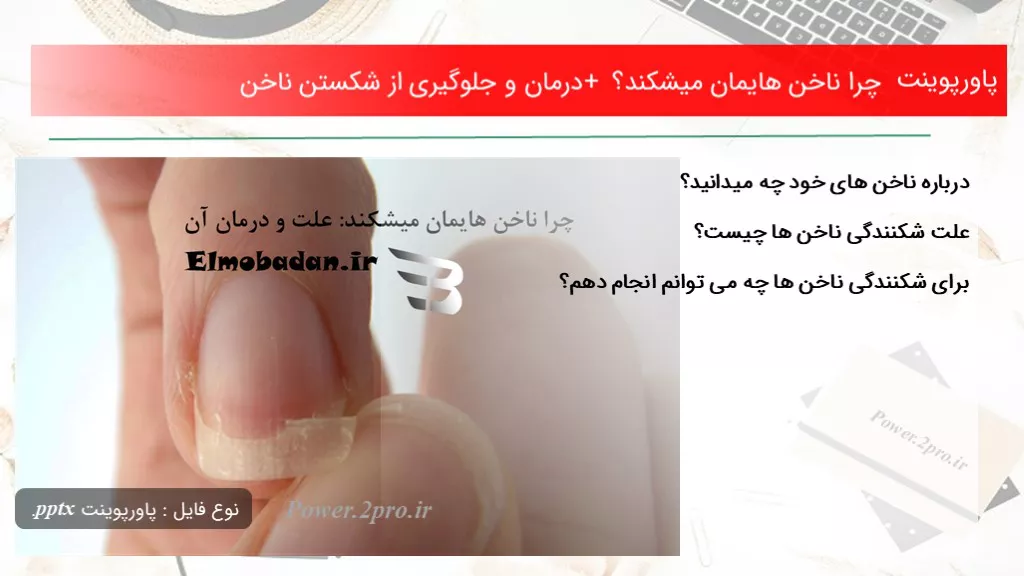 دانلود پاورپوینت چرا ناخن هایمان میشکند؟ + درمان و جلوگیری از شکستن ناخن - کد118673