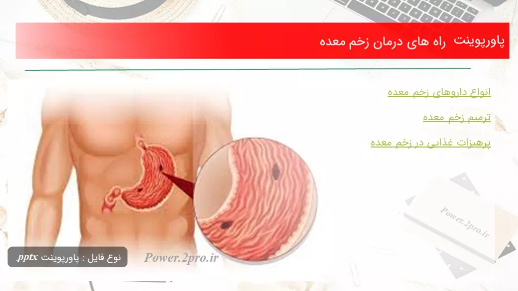 دانلود پاورپوینت راه های درمان زخم معده - کد118823