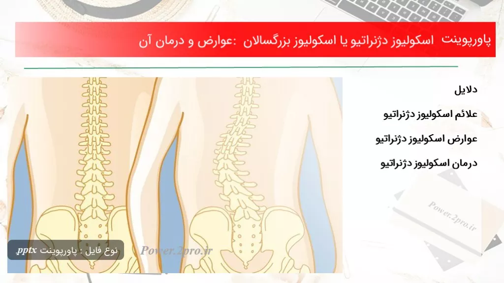 اسکولیوز دژنراتیو یا اسکولیوز بزرگسالان : عوارض و درمان آنتاریخ: شهریور ۲۶, ۱۳۹۹دسته بندی: بیماری هادیدگاه کاربران: بدون دیدگاه تعداد بازدید: 678  بار