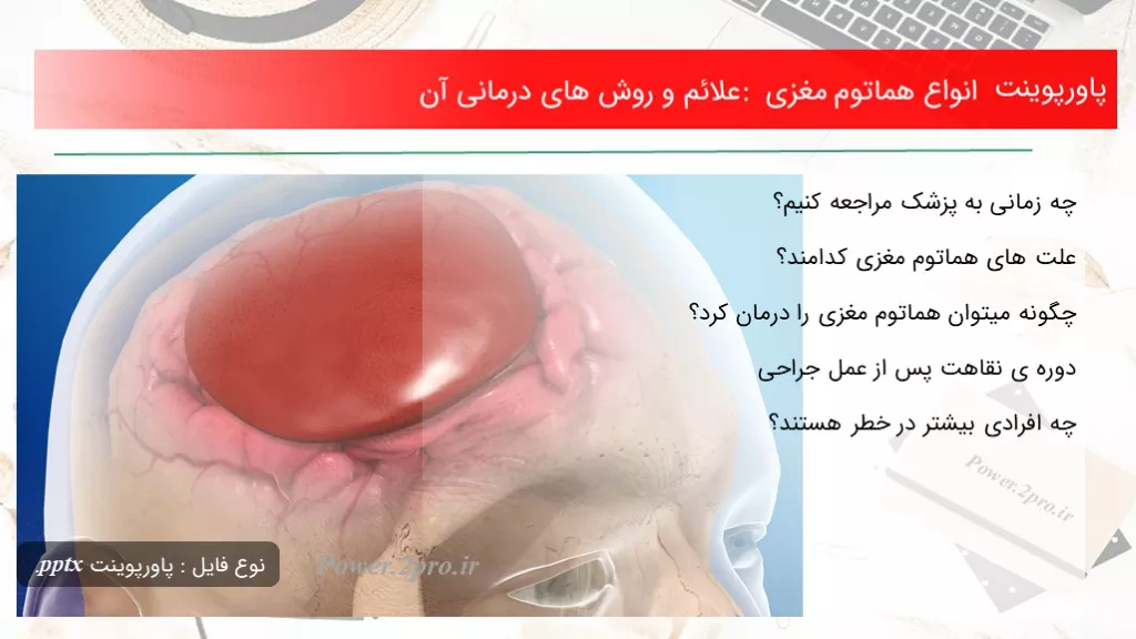 دانلود پاورپوینت انواع هماتوم مغزی : علائم و چگونگی های درمانی آن - کد119030