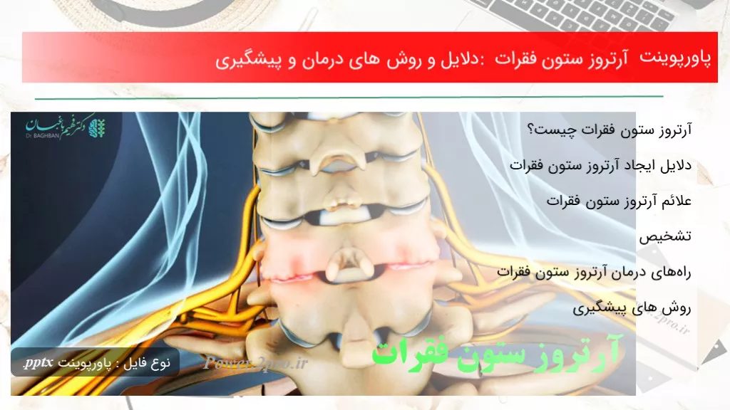 دانلود پاورپوینت آرتروز ستون فقرات : دلایل و چگونگی های درمان و پیشگیری - کد119036