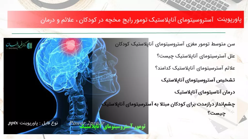 دانلود پاورپوینت آستروسیتومای آناپلاستیک تومور رایج مخچه در کودکان ، علائم و درمان - کد119038