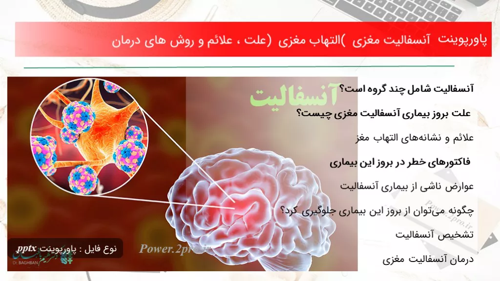 دانلود پاورپوینت آنسفالیت مغزی ( التهاب مغزی ) چرایی ، علائم و چگونگی های درمان - کد119045