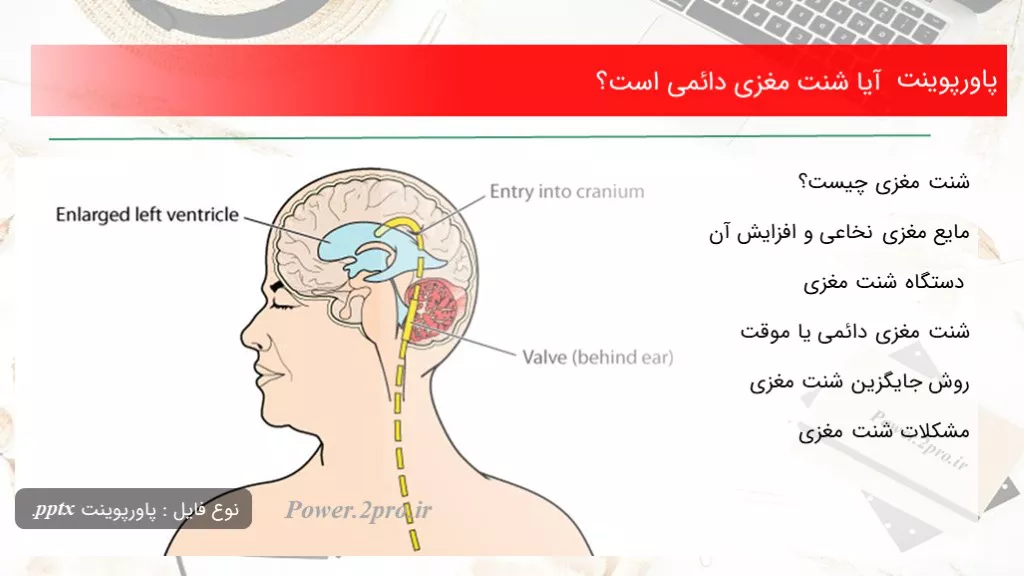 آیا شنت مغزی دائمی است؟تاریخ: دی ۸, ۱۳۹۹دسته بندی: مقالاتدیدگاه کاربران: ۱ دیدگاه تعداد بازدید: 998  بار