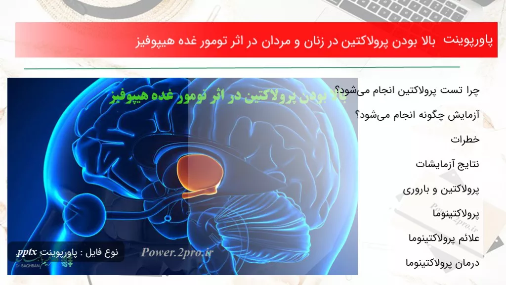 دانلود پاورپوینت بالا بودن پرولاکتین در زنان و مردان در تاثیر  تومور غده هیپوفیز - کد119077