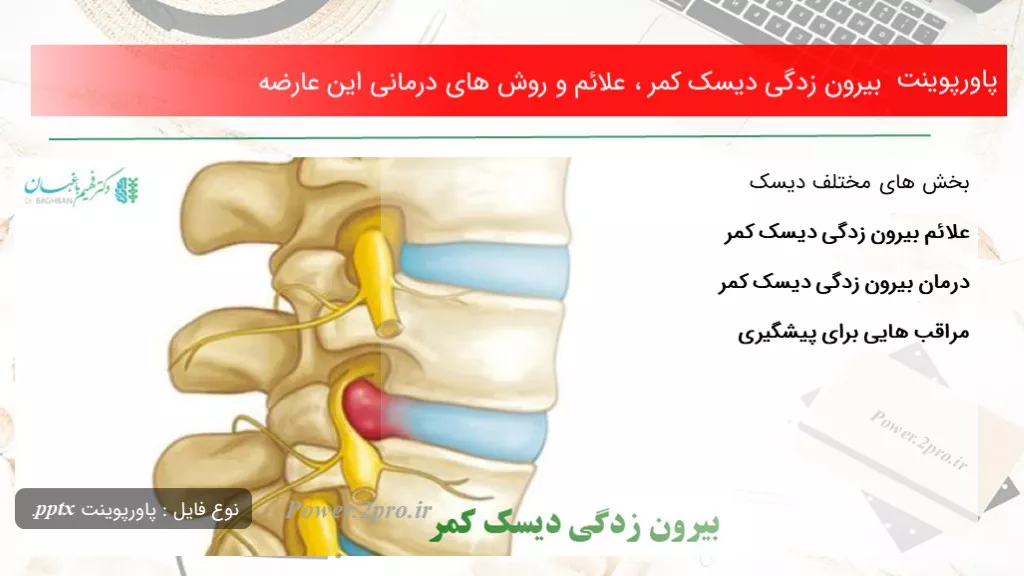 بیرون زدگی دیسک کمر ، علائم و روش های درمانی این عارضهتاریخ: اسفند ۱۹, ۱۳۹۸دسته بندی: بیماری هادیدگاه کاربران: بدون دیدگاه تعداد بازدید: 1560  بار