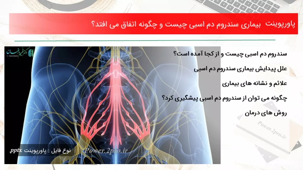 دانلود پاورپوینت بیماری سندروم دم اسبی چه چیزی است و  چطور اتفاق می افتد؟ - کد119097