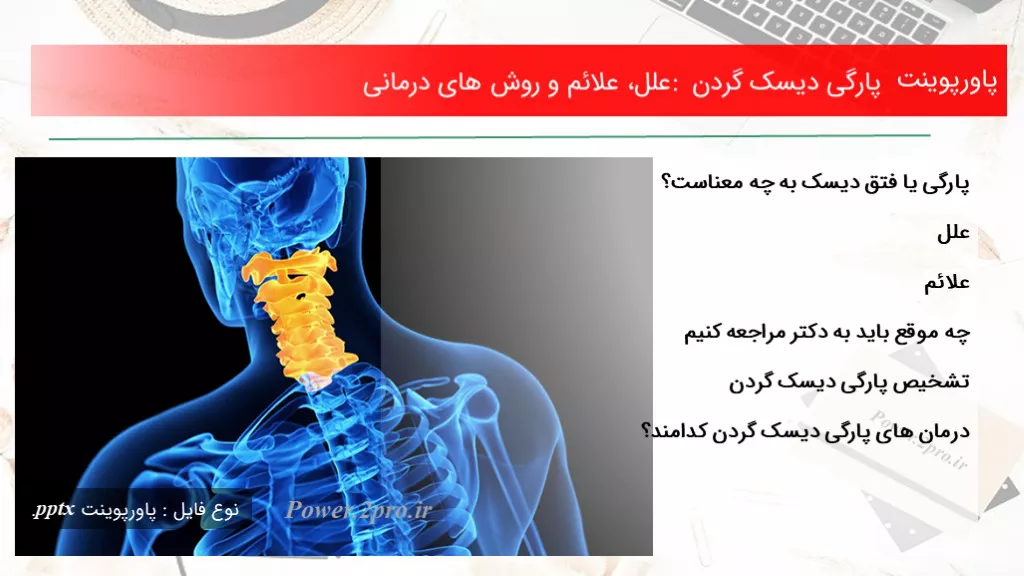 دانلود پاورپوینت پارگی دیسک گردن : علل، علائم و چگونگی های درمانی - کد119101