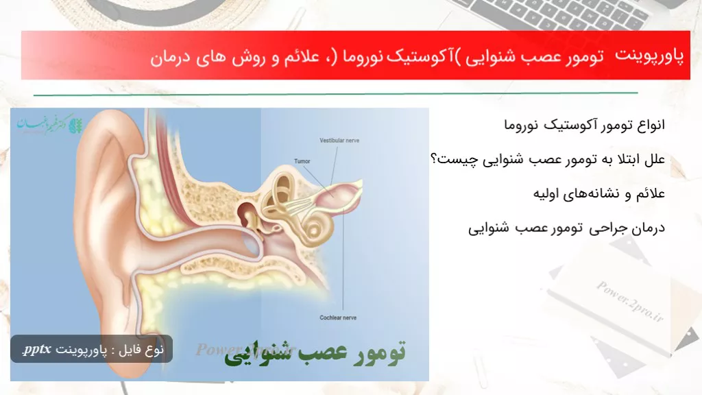 دانلود پاورپوینت تومور عصب شنوایی (آکوستیک نوروما) ، علائم و چگونگی های درمان - کد119124