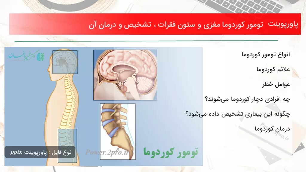 دانلود پاورپوینت تومور کوردوما مغزی و ستون فقرات ، تشخیص و درمان آن - کد119127