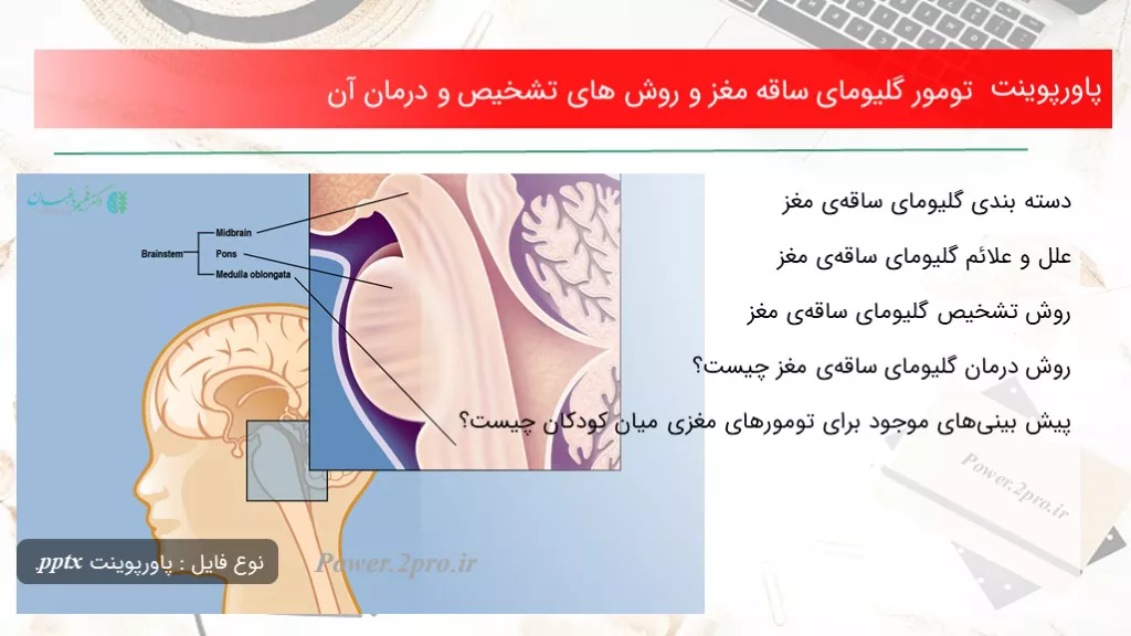 دانلود پاورپوینت تومور گلیومای ساقه مغز و چگونگی های تشخیص و درمان آن - کد119129