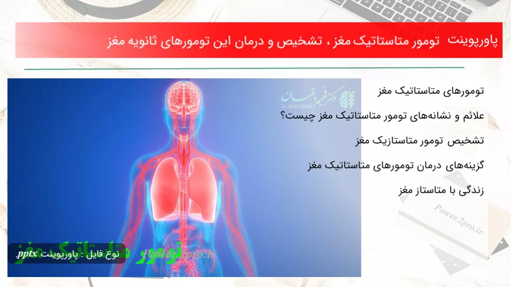 دانلود پاورپوینت تومور متاستاتیک مغز ، تشخیص و درمان این تومورهای ثانویه مغز - کد119130