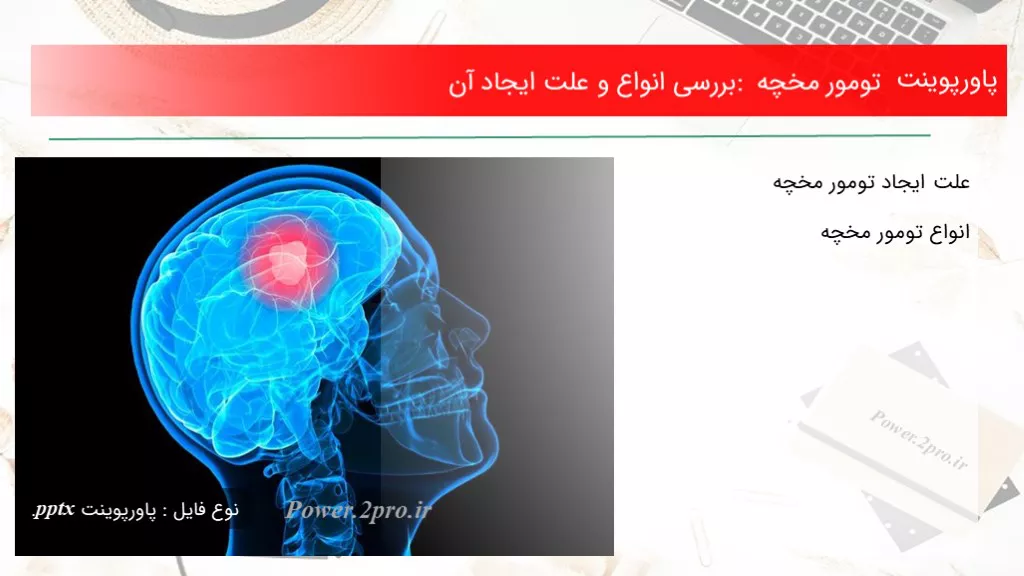 دانلود پاورپوینت تومور مخچه : بررسی انواع و چرایی ایجاد آن - کد119131