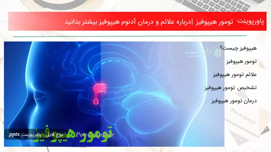 دانلود پاورپوینت تومور هیپوفیز |  درزمینه علائم و درمان آدنوم هیپوفیز اکثر بدانید - کد119137