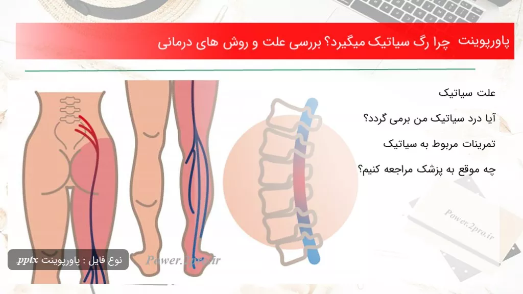 دانلود پاورپوینت چرا رگ سیاتیک میگیرد؟ بررسی چرایی و چگونگی های درمانی - کد119139