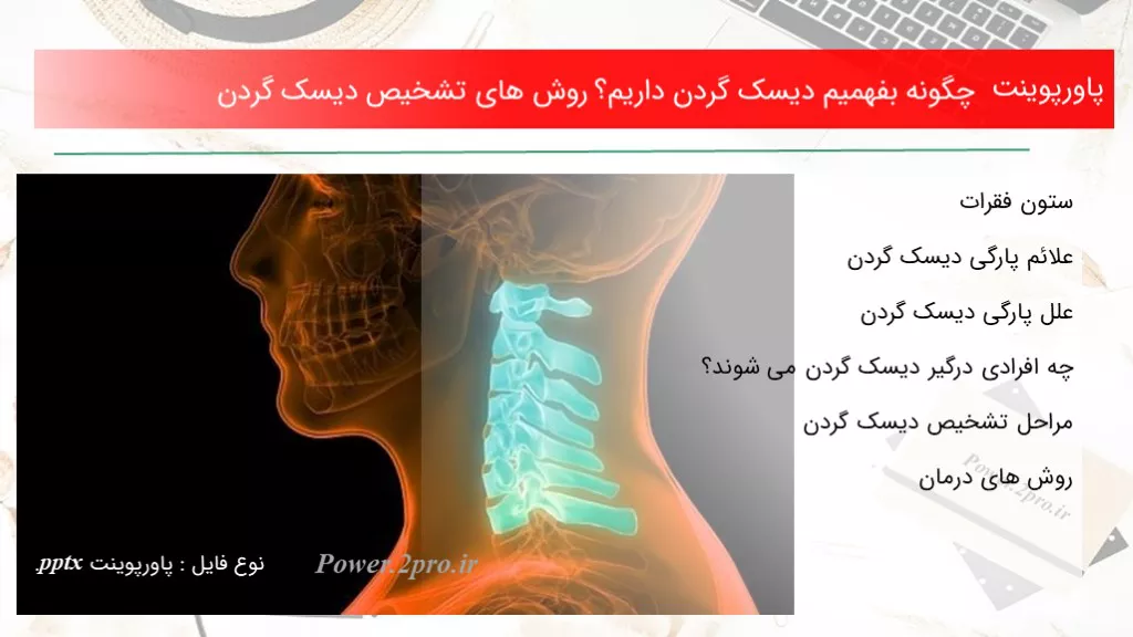 دانلود پاورپوینت  چطور بفهمیم دیسک گردن داریم؟ چگونگی های تشخیص دیسک گردن - کد119159