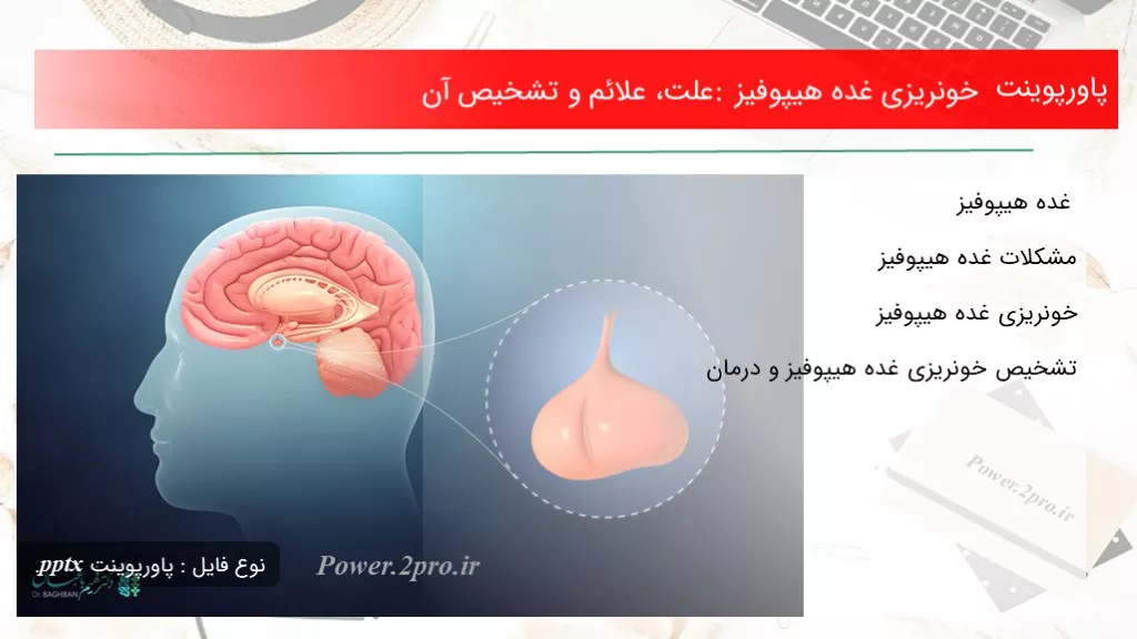 دانلود پاورپوینت خونریزی غده هیپوفیز : چرایی ، علائم و تشخیص آن - کد119198