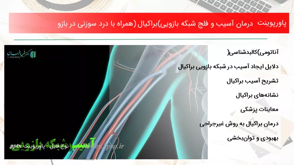 دانلود پاورپوینت درمان آسیب و فلج شبکه بازویی(براکیال) همراه با درد سوزنی در بازو - کد119206