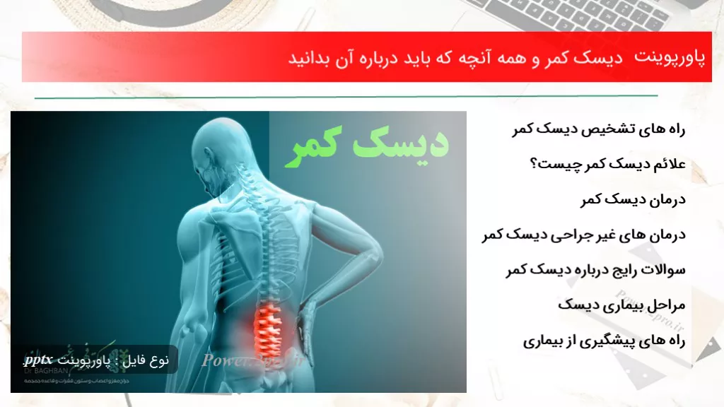 دانلود پاورپوینت دیسک کمر و همه آنچه که باید  درزمینه آن بدانید - کد119218