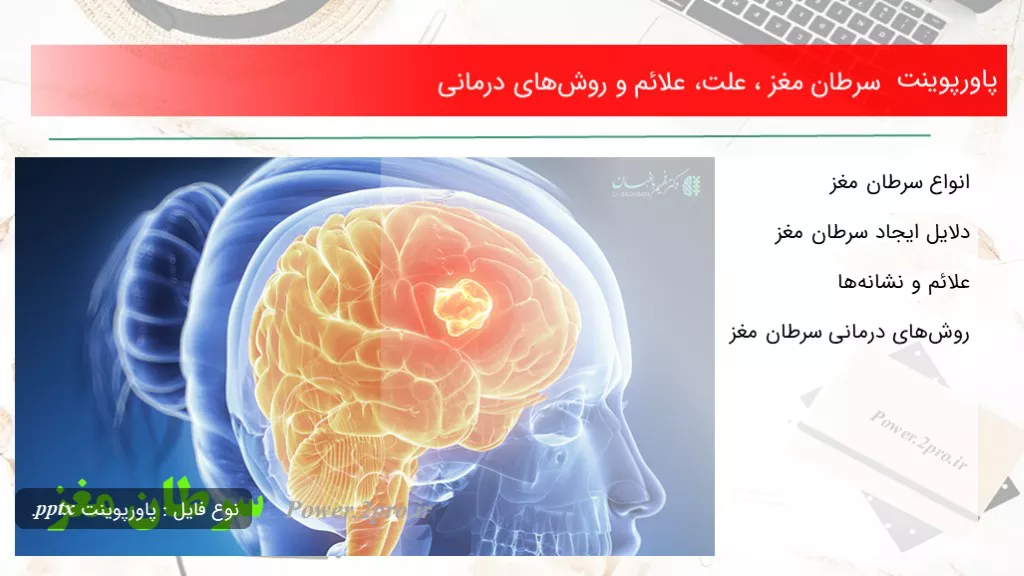 دانلود پاورپوینت سرطان مغز ، چرایی ، علائم و روش‌های درمانی - کد119242