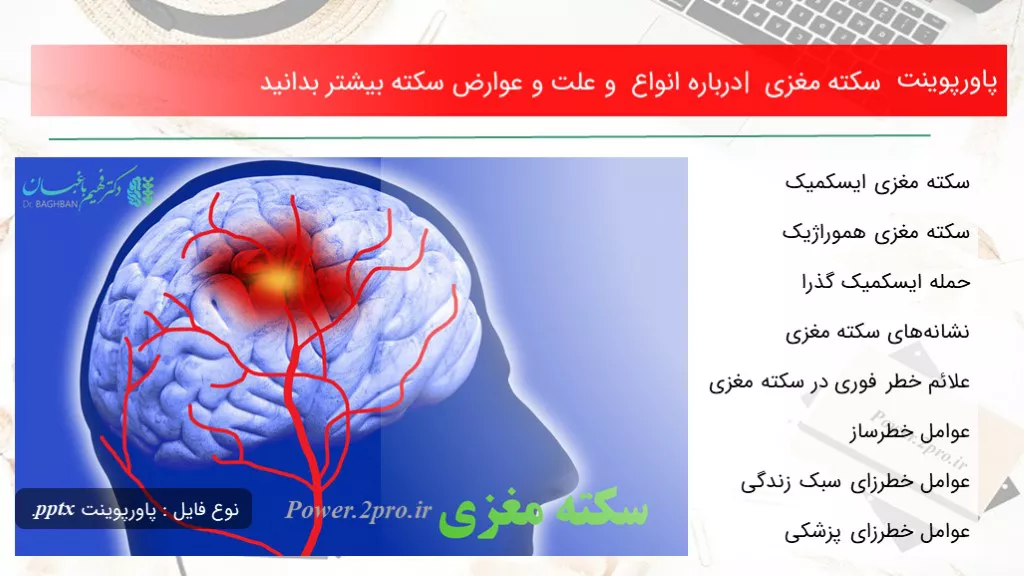 دانلود پاورپوینت سکته مغزی |  درزمینه انواع و  چرایی و عوارض سکته  اکثر بدانید - کد119244