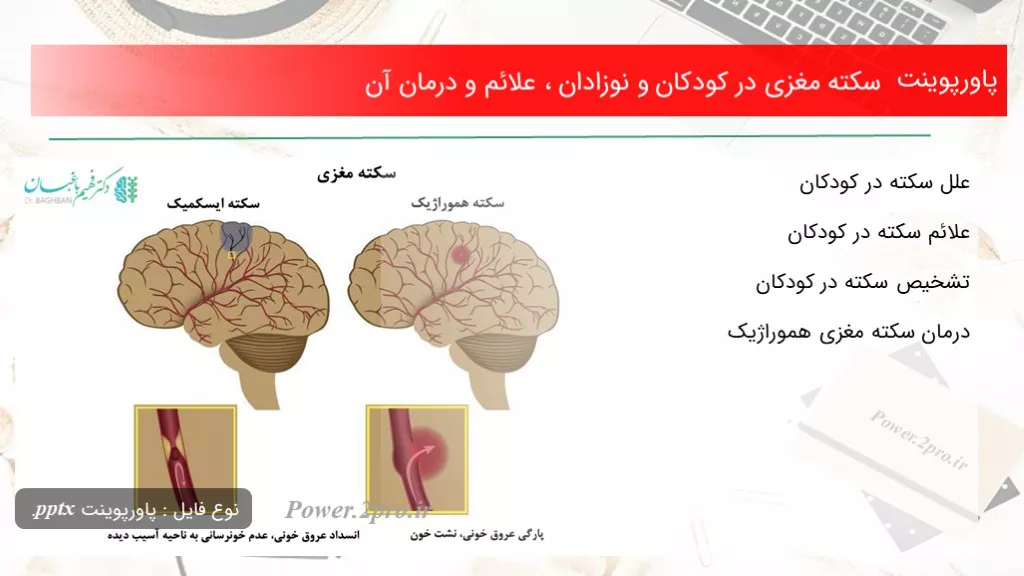 سکته مغزی در کودکان و نوزادان ، علائم و درمان آنتاریخ: اسفند ۱۴, ۱۳۹۸دسته بندی: مقالاتدیدگاه کاربران: بدون دیدگاه تعداد بازدید: 1951  بار