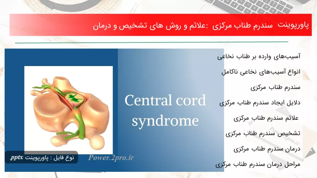 دانلود پاورپوینت سندرم طناب مرکزی : علائم و چگونگی های تشخیص و درمان - کد119246