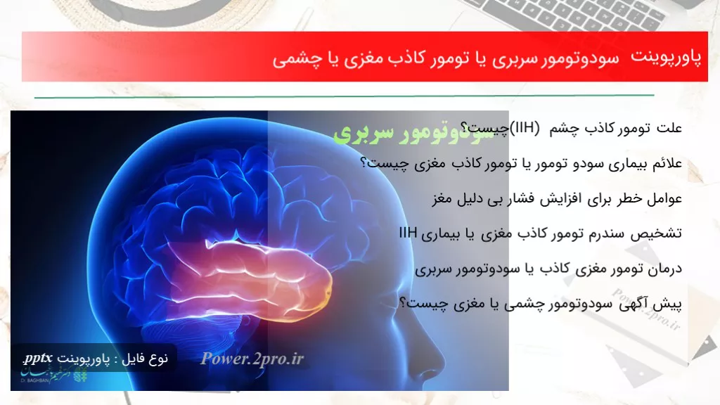 دانلود پاورپوینت سودوتومور سربری یا تومور کاذب مغزی یا چشمی - کد119250