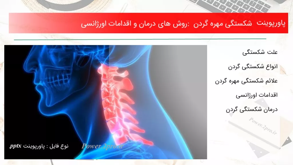 دانلود پاورپوینت شکستگی مهره گردن : چگونگی های درمان و اقدامات اورژانسی - کد119258