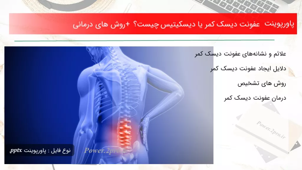 عفونت دیسک کمر یا دیسکیتیس چیست؟ + روش های درمانیتاریخ: مهر ۲, ۱۳۹۹دسته بندی: بیماری هادیدگاه کاربران: ۱ دیدگاه تعداد بازدید: 1150  بار