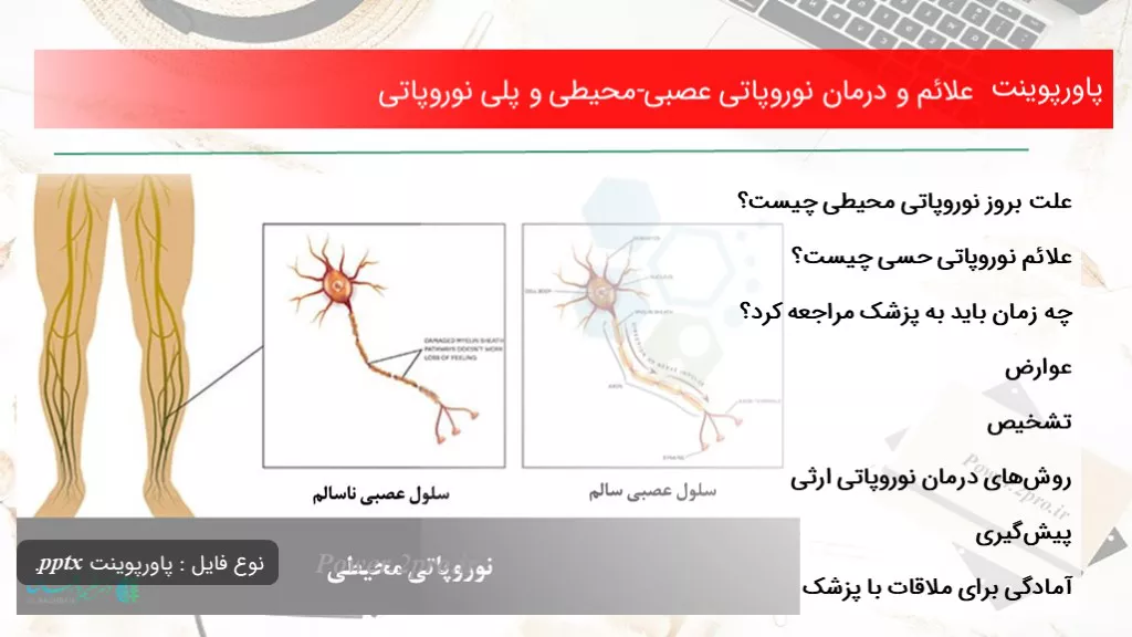 دانلود پاورپوینت علائم و درمان نوروپاتی عصبی-محیطی و پلی نوروپاتی - کد119272