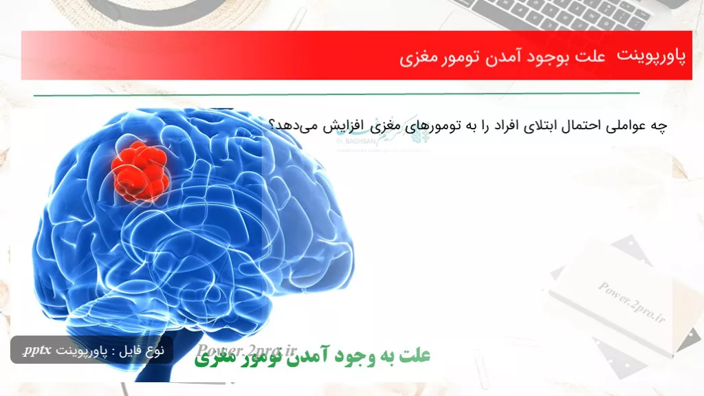 دانلود پاورپوینت چرایی بوجود آمدن تومور مغزی - کد119274