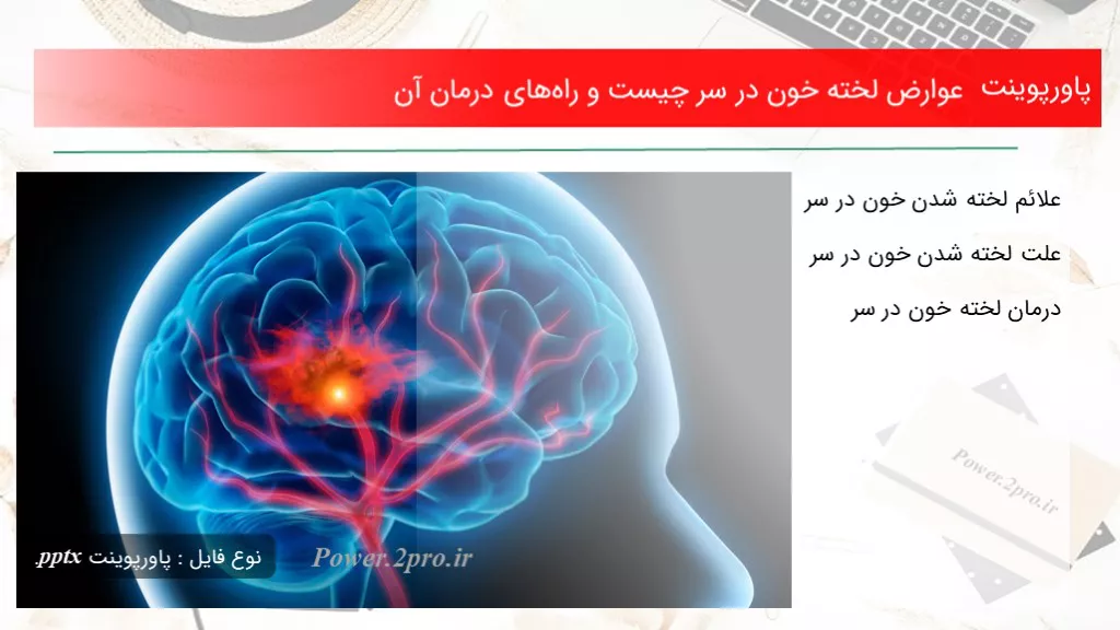 دانلود پاورپوینت عوارض لخته خون در سر چه چیزی است و راه‌های درمان آن - کد119283