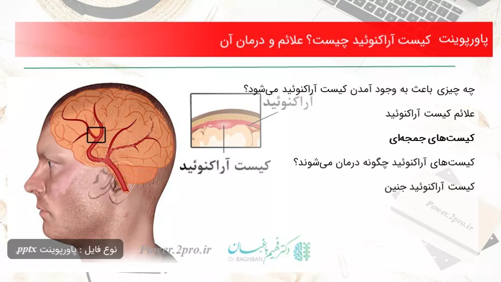 کیست آراکنوئید چیست؟ علائم و درمان آنتاریخ: بهمن ۱۶, ۱۳۹۸دسته بندی: بیماری هادیدگاه کاربران: ۱ دیدگاه تعداد بازدید: 2932  بار