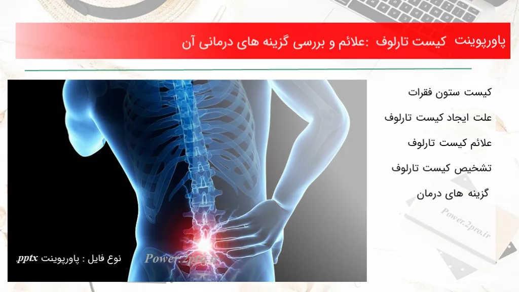 دانلود پاورپوینت کیست تارلوف : علائم و بررسی گزینه های درمانی آن - کد119307