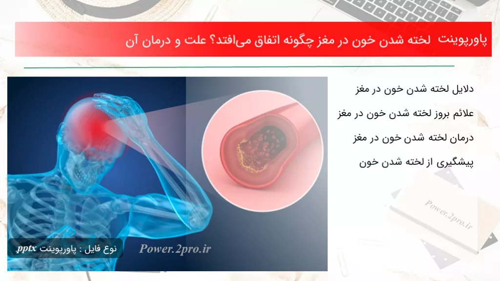 دانلود پاورپوینت لخته شدن خون در مغز  چطور اتفاق می‌افتد؟ چرایی و درمان آن - کد119314