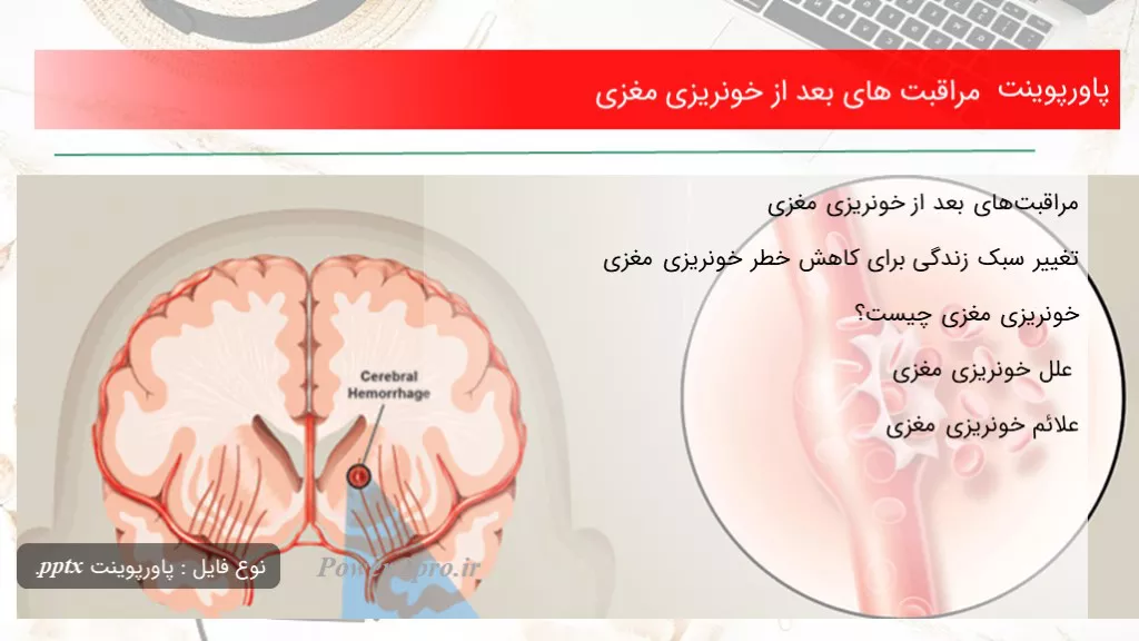 دانلود پاورپوینت مراقبت های بعد از خونریزی مغزی - کد119317